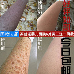 Remove the skin pimple cream dry desquamation cockatrice scale leg veins moisturizing body lotion all
